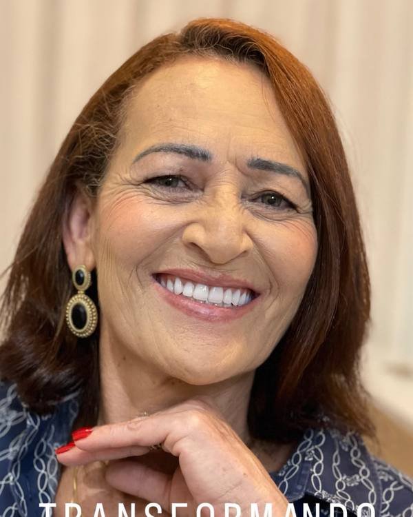 Paciente sorrindo na Verdum Odontologia, em Sinop
