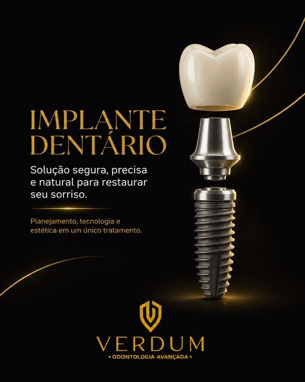 Implante dentário — Verdum Odontologia