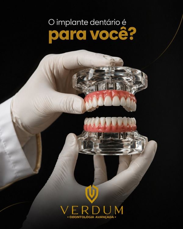 Protocolo sobre implantes — Verdum Odontologia