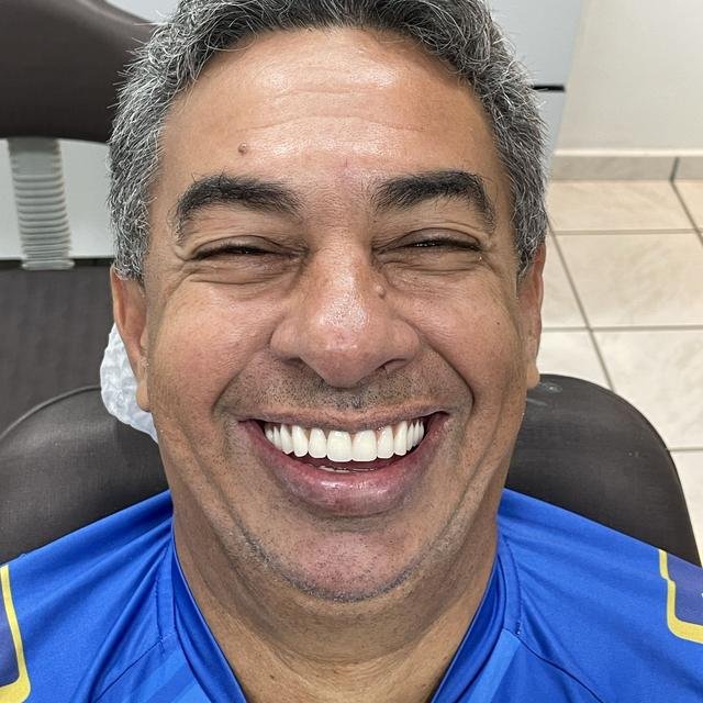 Paciente sorrindo na Verdum Odontologia, em Sinop